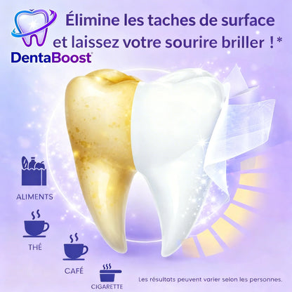 Améthyste Blanche — 14 Bandelettes Blanchissantes Premium